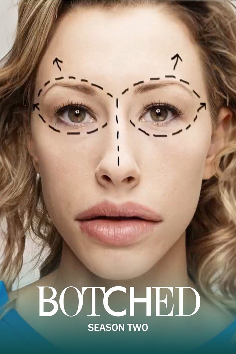 Botched S02