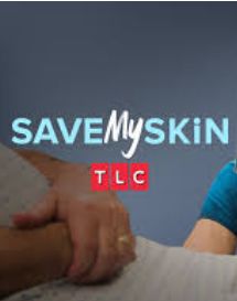 Save My Skin S04